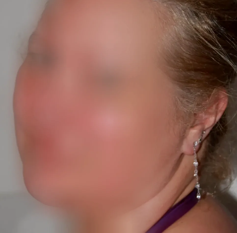 Aylin, 28